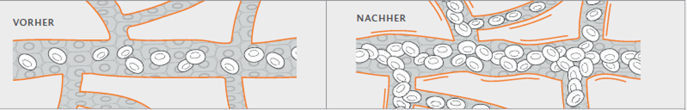 Zirkulation-vorher-nachher-L Zirkulation-vorher-nachher-L