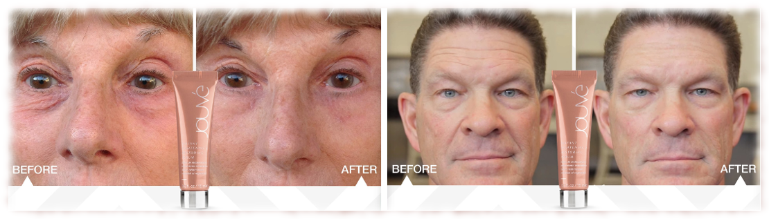 Tightening-Serum-HP-110x317 Tightening-Serum-HP-110x317