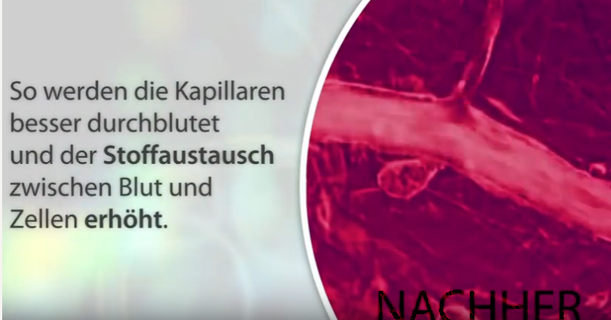 Nachher Bemer Nachher Bemer